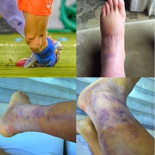 Alexis Sanchez anh 2