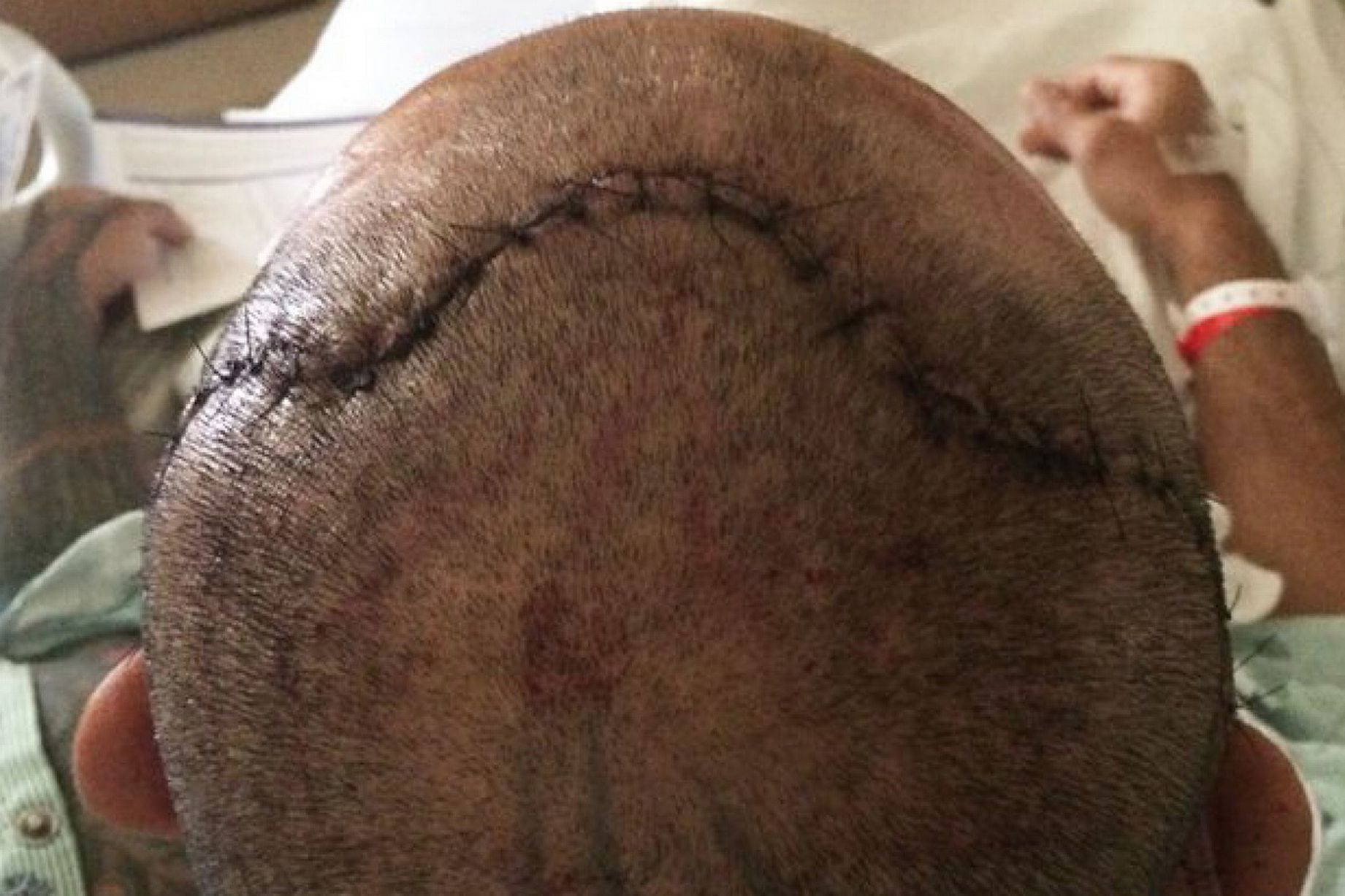 vo si nut hop so anh 6