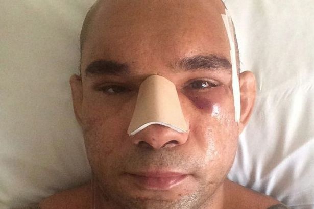 vo si nut hop so anh 4