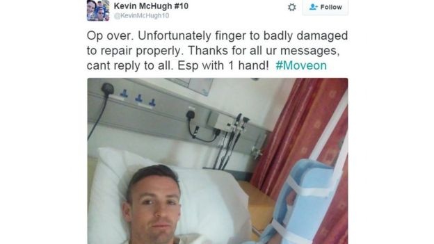 cầu thủ bị mất ngón tay ảnh 2 cau thu bi mat ngon tay anh 2