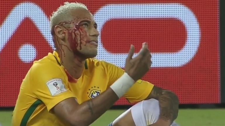 Neymar: ‘Se tiep tuc pho dien, ghet cu danh cui cho’ hinh anh