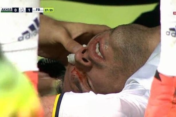 Va cham manh, Van Persie chay mau o mat hinh anh