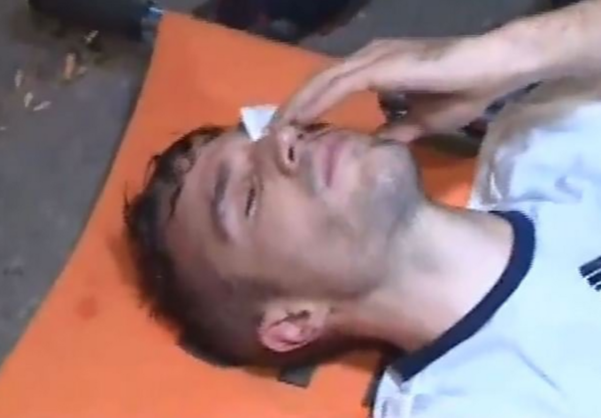 Van Persie chan thuong vung mat anh 2