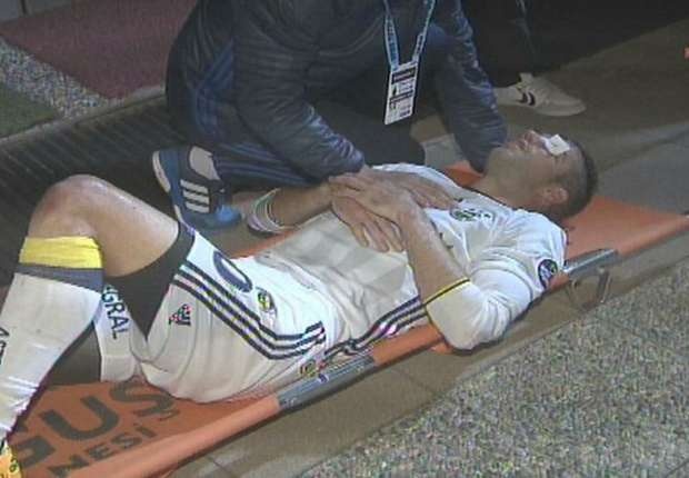 Van Persie chan thuong vung mat anh 1