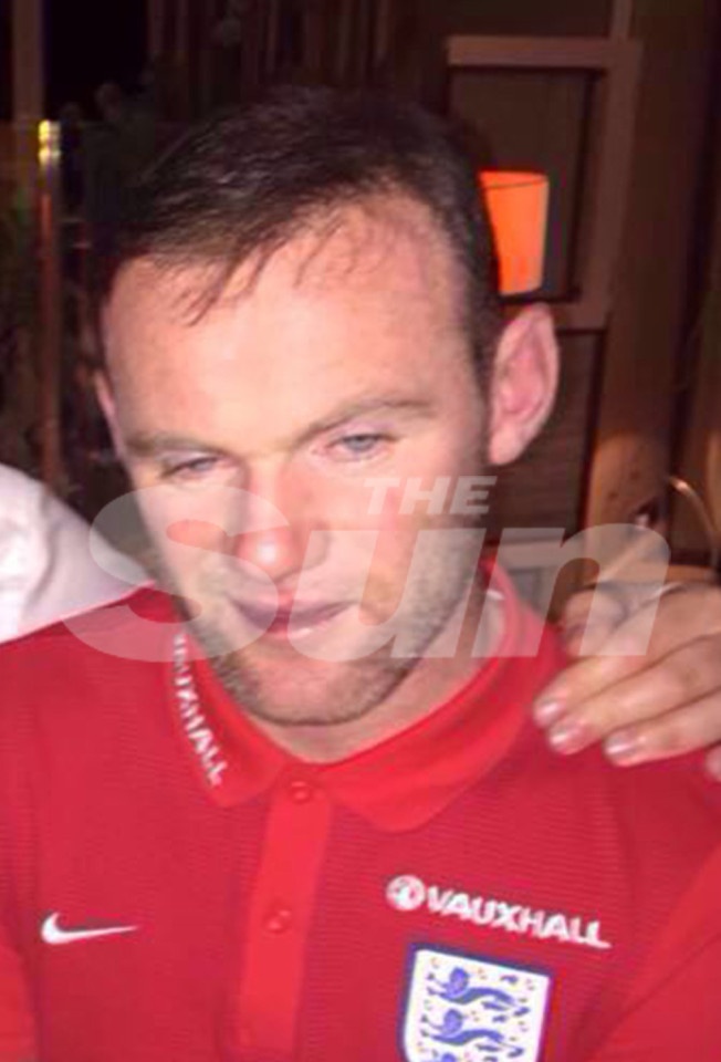 Rooney lộ hình ảnh bệ rạc ảnh 1 Rooney lo hinh anh be rac anh 1
