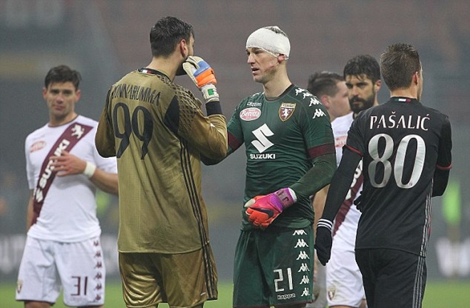 Joe Hart bị sưng mặt ảnh 6 Joe Hart bi sung mat anh 6