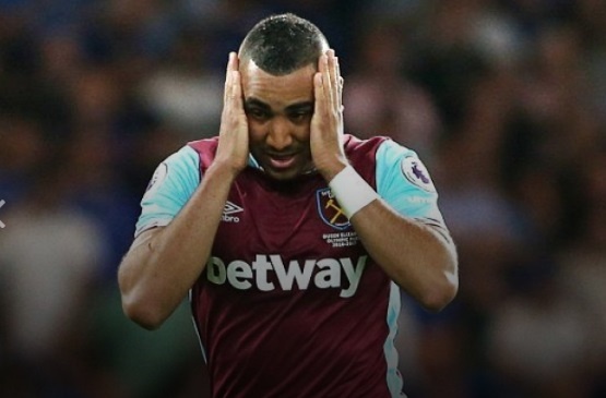 Ao Payet bi cac fan giay vo tham hai hinh anh