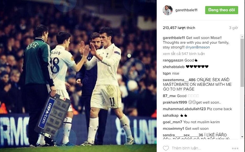 Cau thu Hull bi nut so anh 7