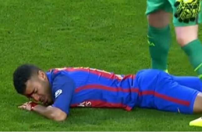 Rafinha dính chấn thương ở trán ảnh 1 Rafinha dinh chan thuong o tran anh 1