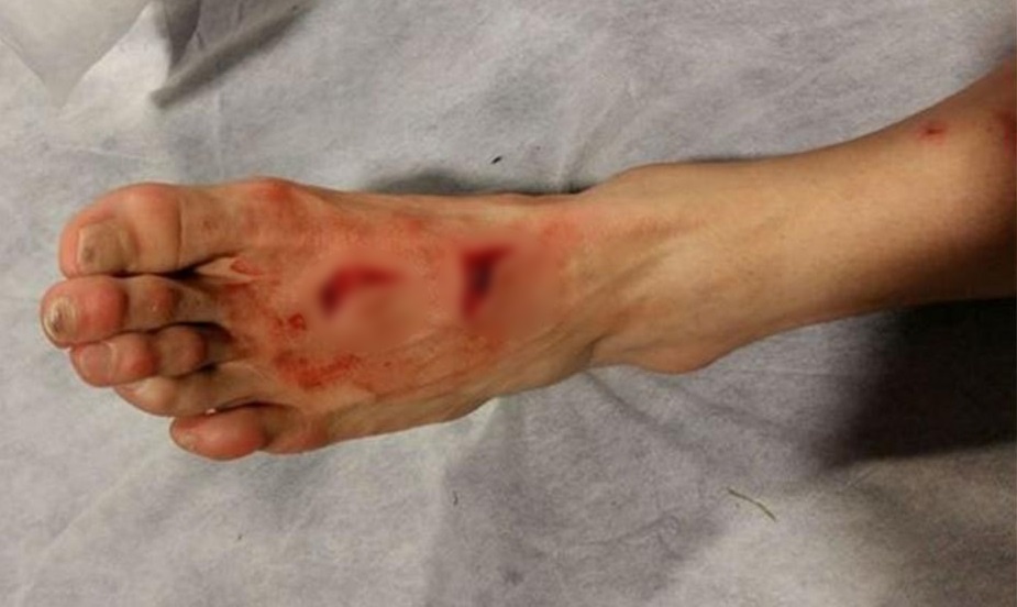 tran Porto vs Juventus anh 1