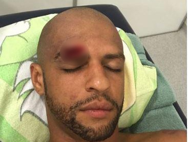 ‘Thung rac vang’ Brazil dinh chan thuong kinh di hinh anh