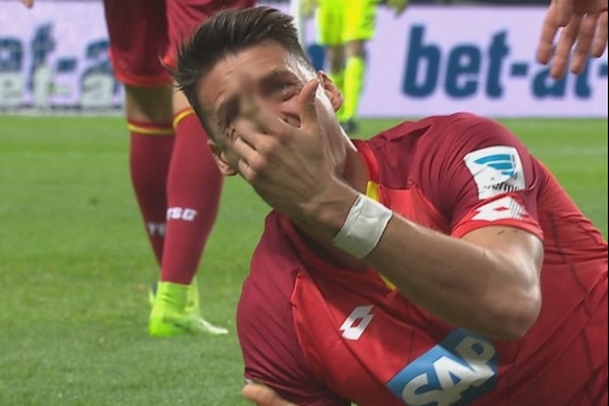 Ngoi sao Bundesliga gay ngon tay kinh di hinh anh