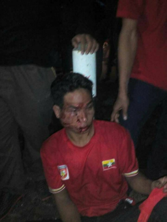 CDV Myanmar bi danh sung mat anh 2