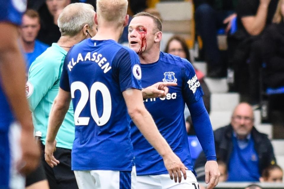 Rooney chay mau anh 4