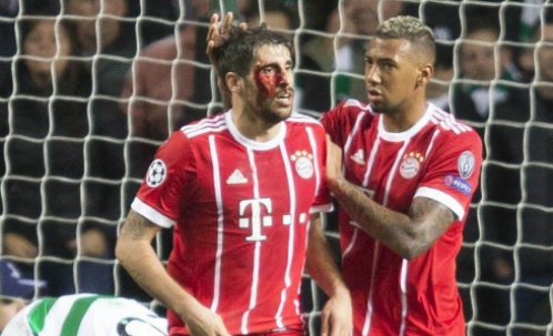 trận Celtic 1-2 Bayern ảnh 6 tran Celtic 1-2 Bayern anh 6