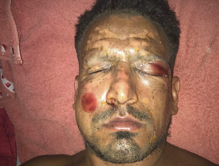 Dot phao hoa dem Giang sinh, cau thu suyt mu mat hinh anh