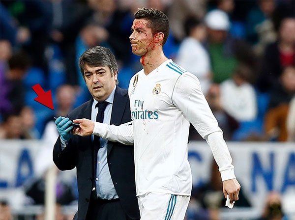 Ronaldo do mau anh 4