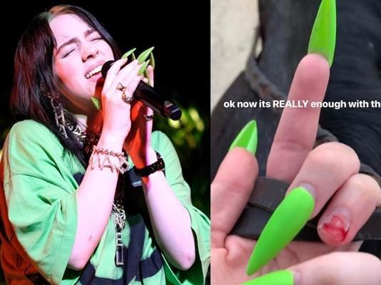 Ngoi sao Billie Eilish chiu dau don vi thu choi mong tay dai hinh anh