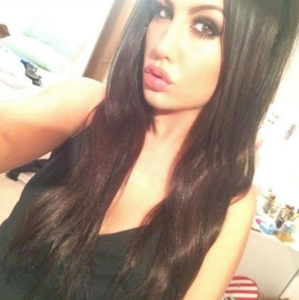 cô gái gặp biến chứng vì bơm môi ảnh 1 co gai gap bien chung vi bom moi anh 1