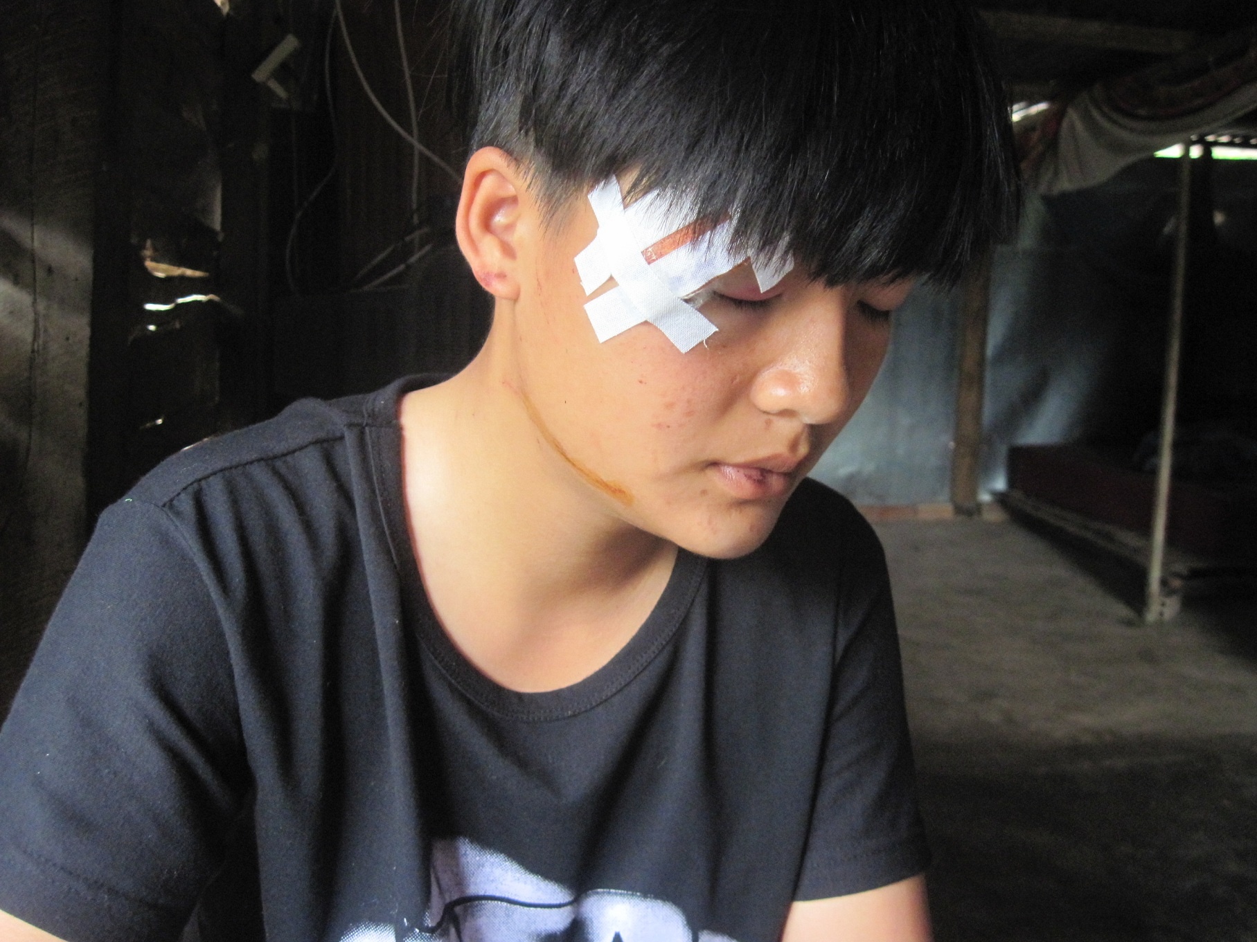 Chị Phượng bị đánh mắt sưng vù không thể mở được.