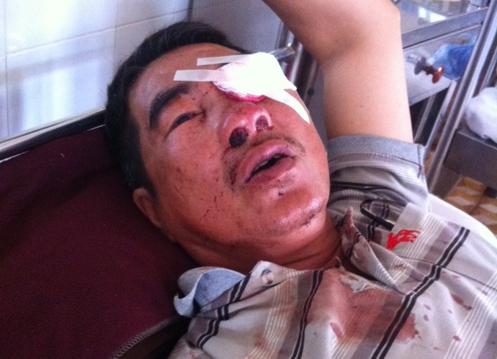 Nhung vu nem da oto, hanh khach chan thuong nang hinh anh