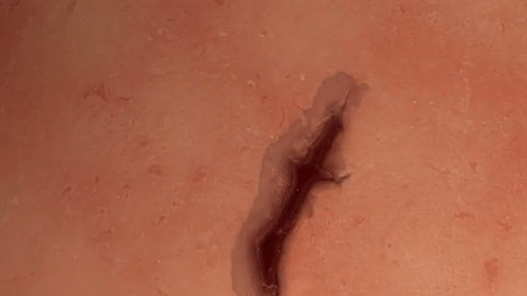 Keo va vet thuong sieu toc hinh anh