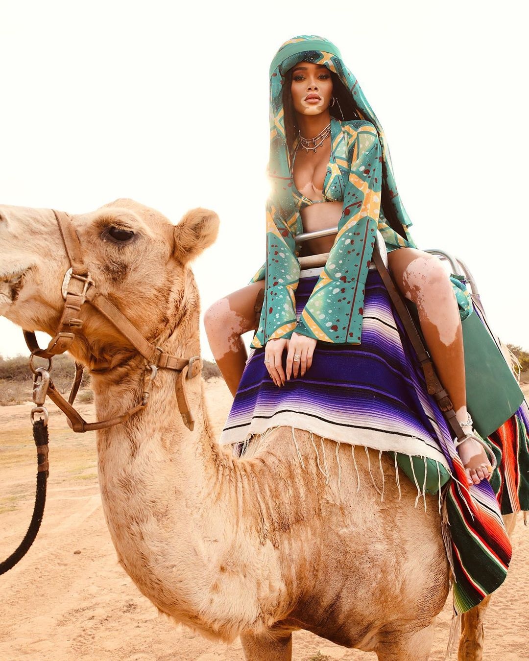 siêu mẫu Winnie Harlow mặc bikini ảnh 4 sieu mau Winnie Harlow mac bikini anh 4