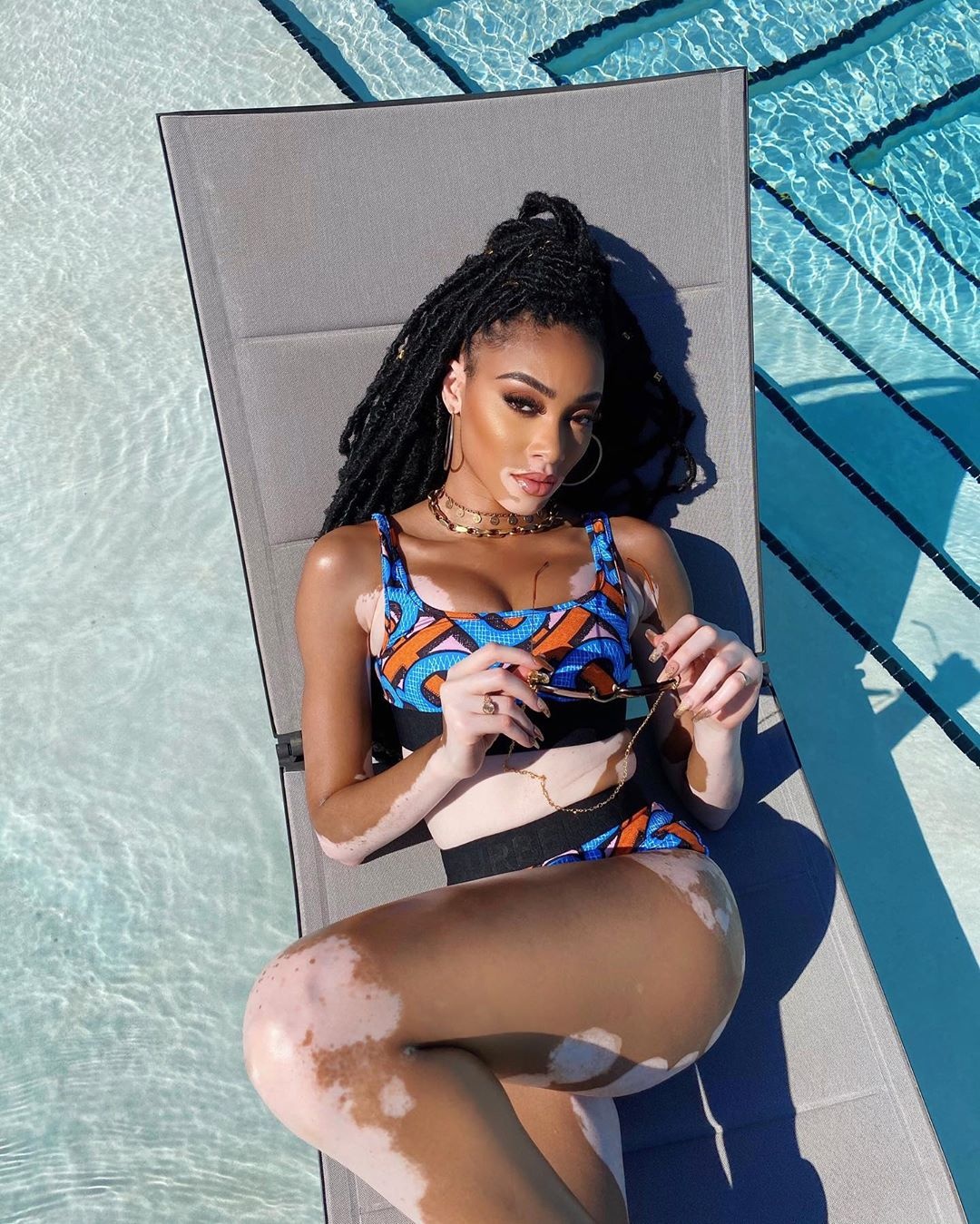 siêu mẫu Winnie Harlow mặc bikini ảnh 11 sieu mau Winnie Harlow mac bikini anh 11