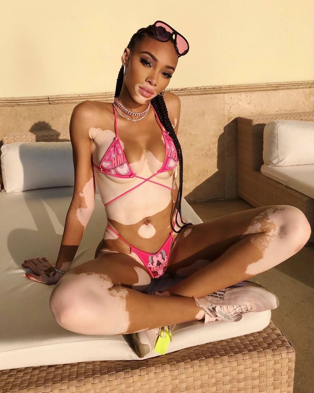 siêu mẫu Winnie Harlow mặc bikini ảnh 7 sieu mau Winnie Harlow mac bikini anh 7