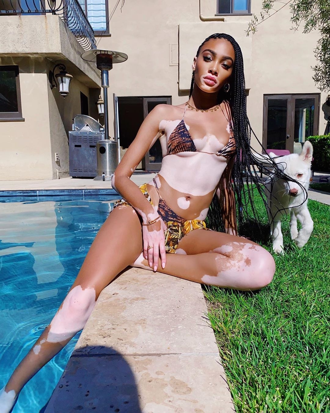 siêu mẫu Winnie Harlow mặc bikini ảnh 8 sieu mau Winnie Harlow mac bikini anh 8