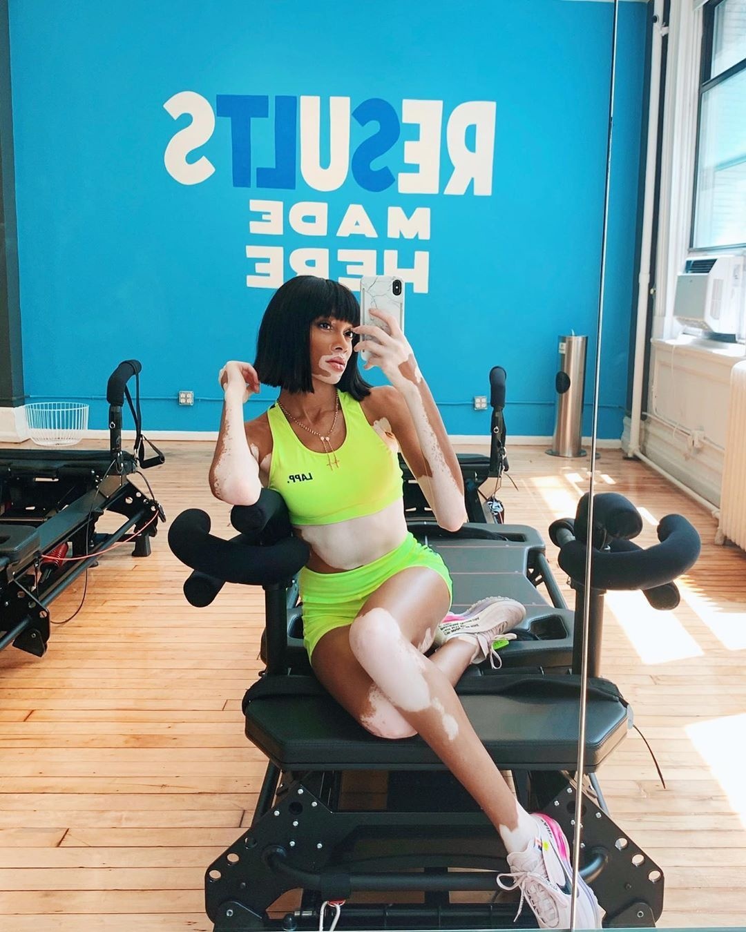 siêu mẫu Winnie Harlow mặc bikini ảnh 14 sieu mau Winnie Harlow mac bikini anh 14