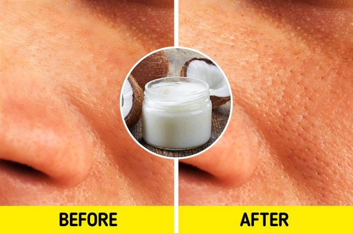 meo lam dep khong hieu qua anh 5