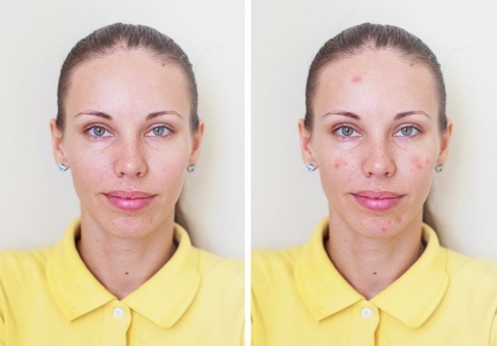 nguyen lieu tu nhien co hai cho da anh 5