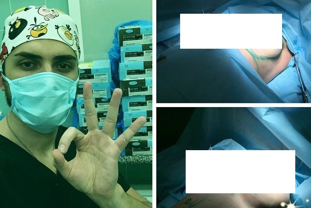 selfie phan cam anh 7