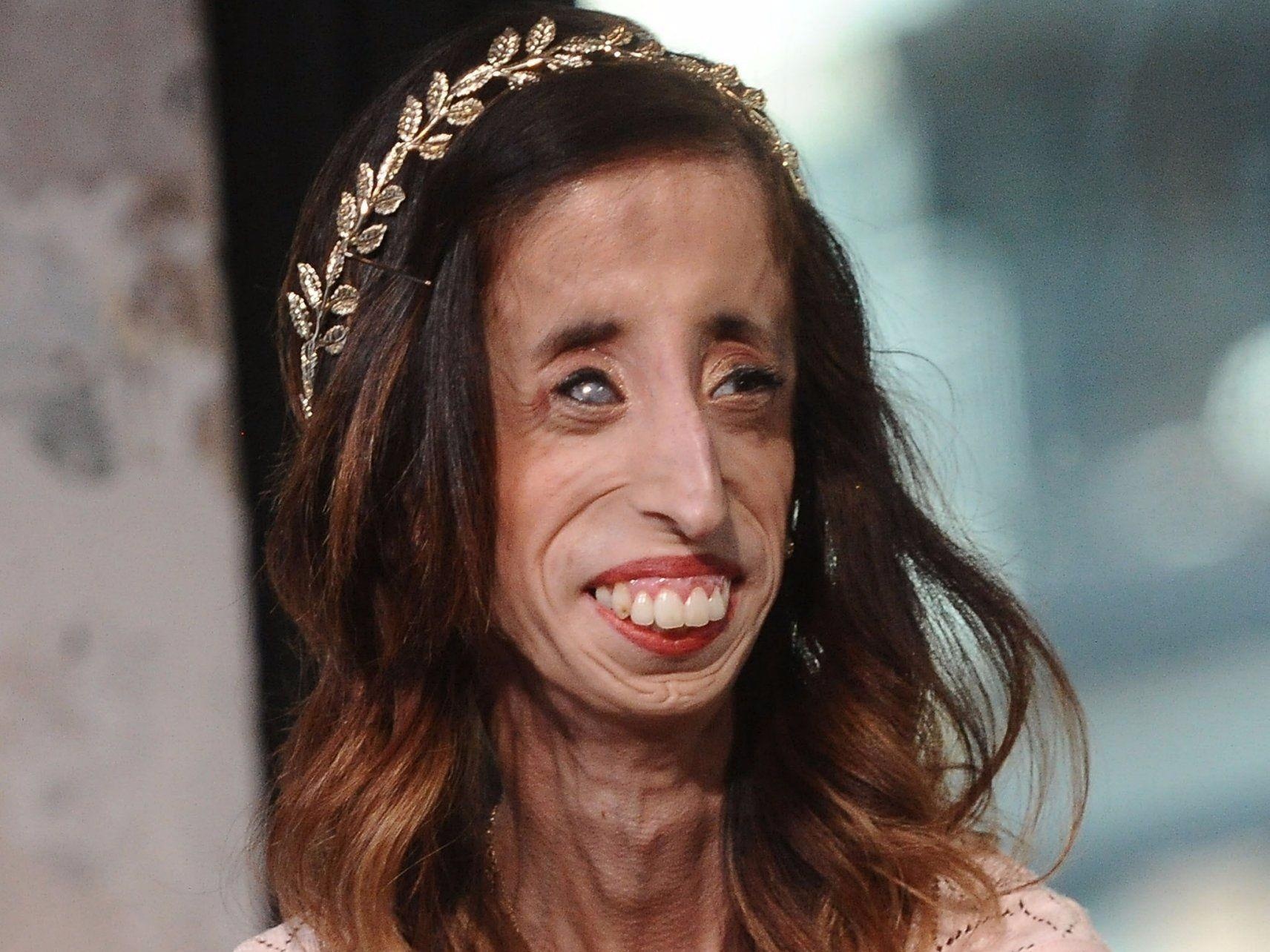 Clip ve cuoc doi co gai xau xi hinh anh