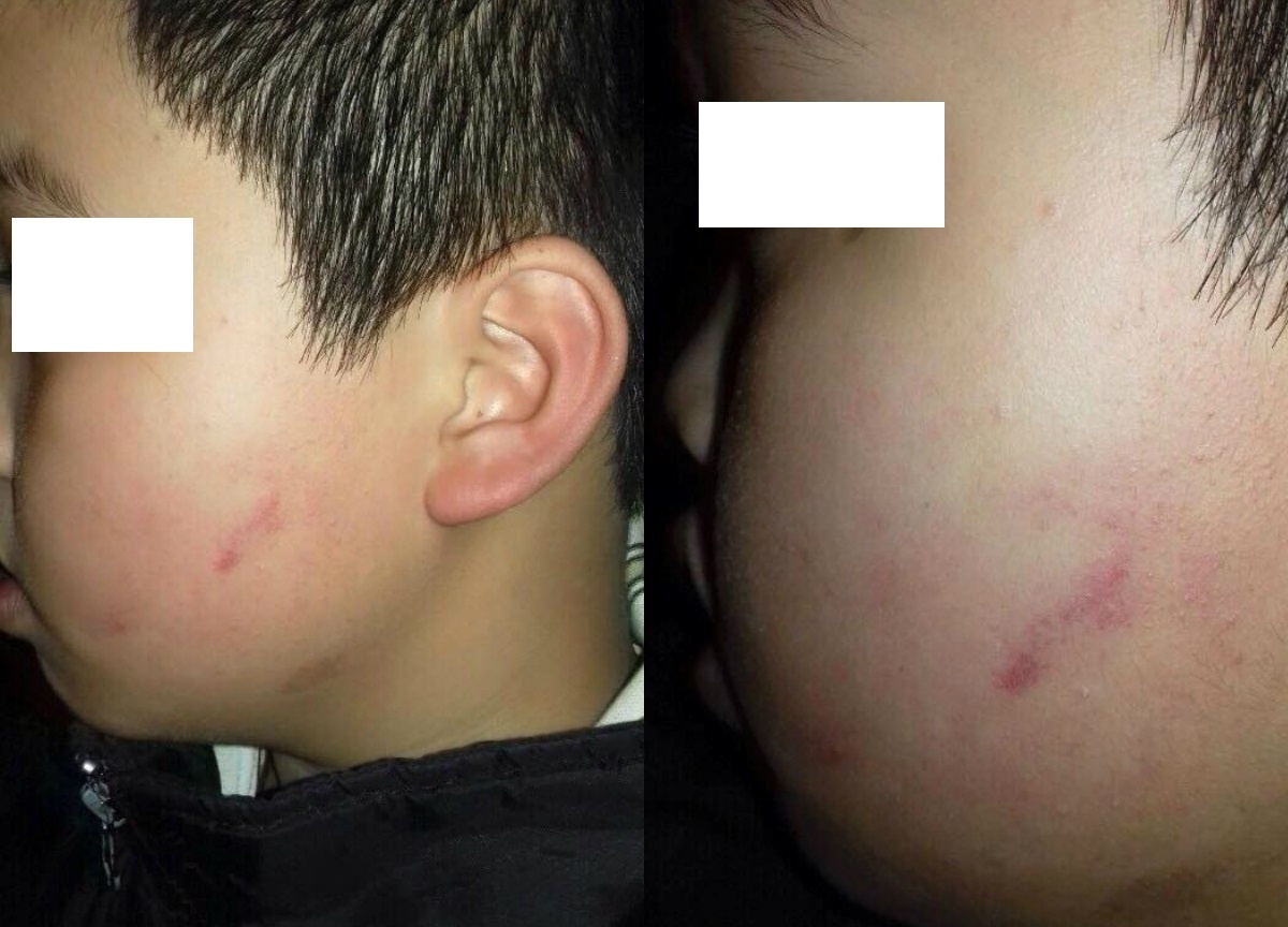 nam sinh bi 42 ban tat vao mat anh 1