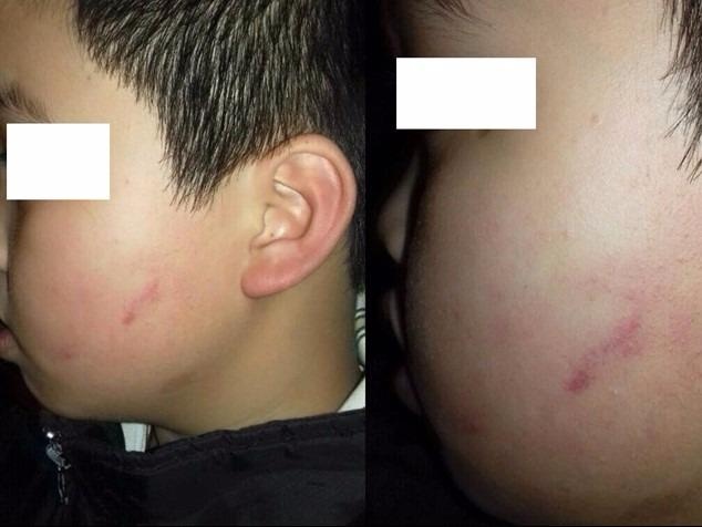 Chu tich Ha Noi yeu cau lam ro vu be trai bi 42 ban tat hinh anh