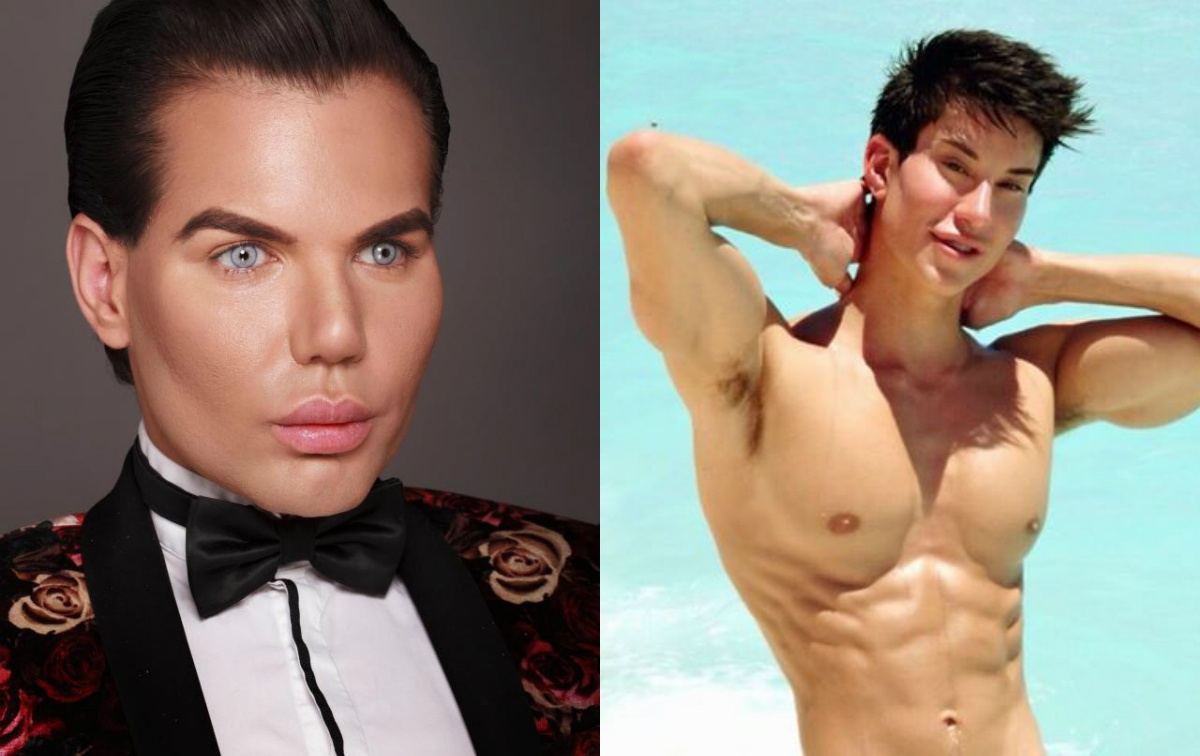 trao luu phau thuat tham my anh 3