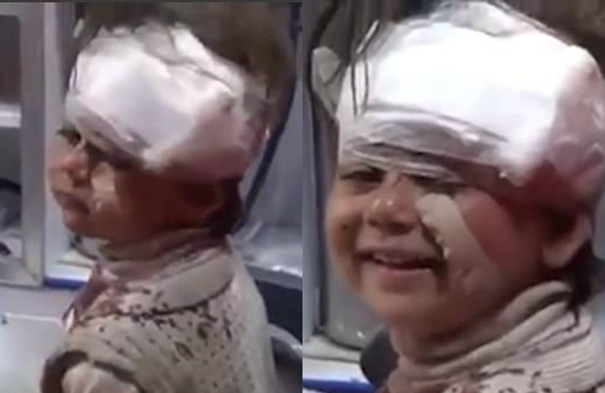 Cô bé Syria bị thương mỉm cười trước camera ảnh 1 Co be Syria bi thuong mim cuoi truoc camera anh 1