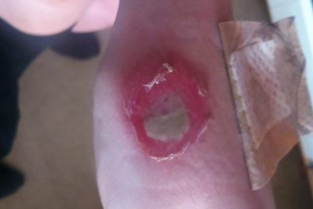 Deodorant Challenge anh 2