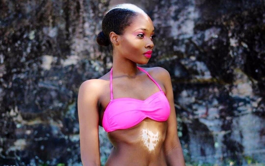 Rebecca Heckard tu tin voi co the khac biet hinh anh