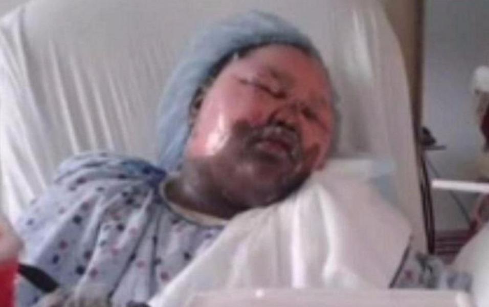 Co be 11 tuoi bong nang do bi ban than tat nuoc soi hinh anh