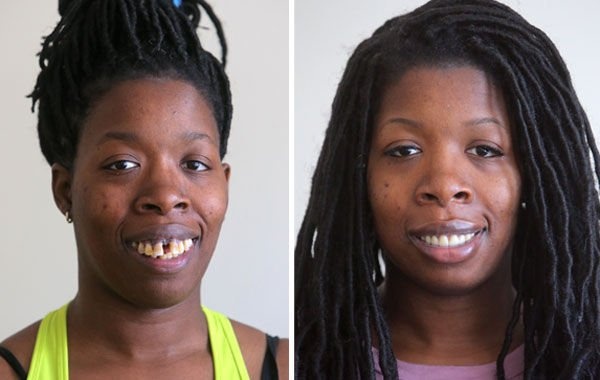 nguoi phu nu bi che gieu vi ham rang xau xi anh 4