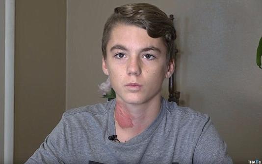 Nam sinh 15 tuoi ke lai chuyen bi ban hat nuoc soi hinh anh