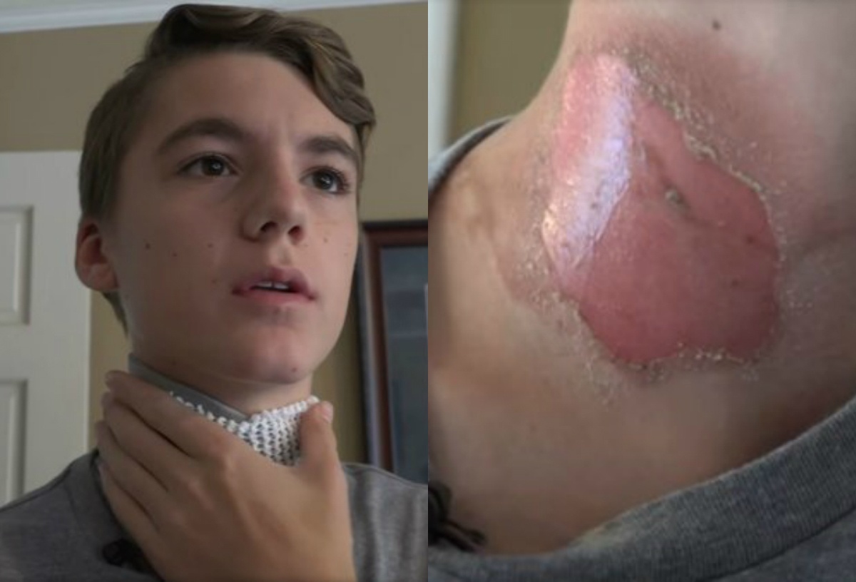 thu thach nuoc soi anh 1