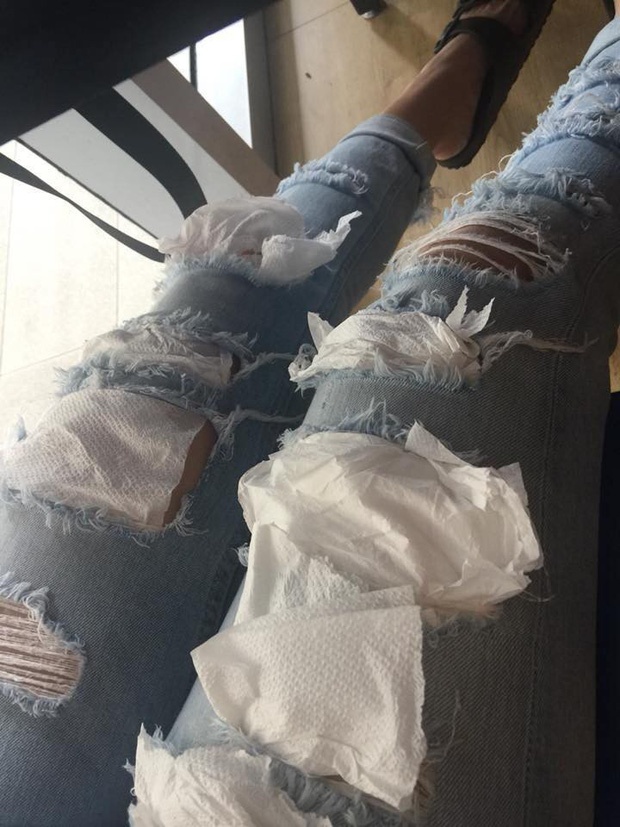 chàng trai vá quần jeans rách cho bạn gái bằng giấy ăn ảnh 2 chang trai va quan jeans rach cho ban gai bang giay an anh 2