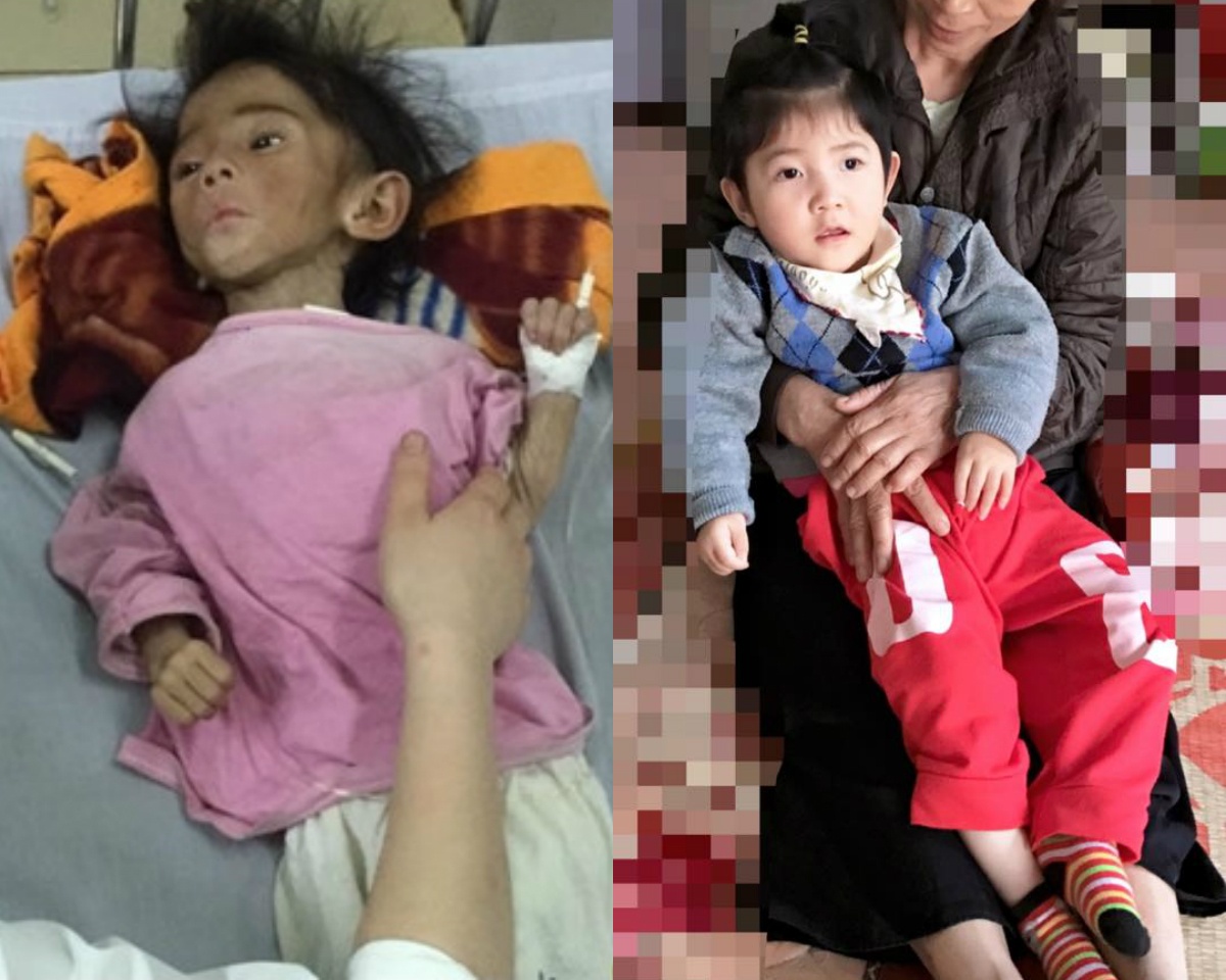 Cô gái cứu bé bại não ở Lào Cai ảnh 1 Co gai cuu be bai nao o Lao Cai anh 1