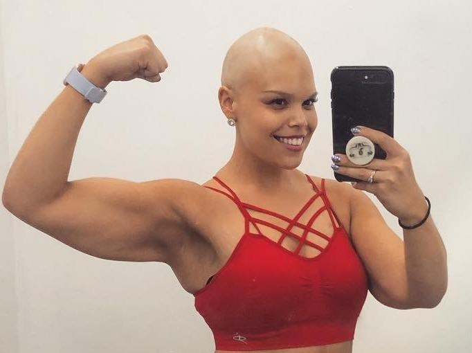 Het beo phi lai ung thu, cuoc song van khong lam kho duoc co gai nay hinh anh