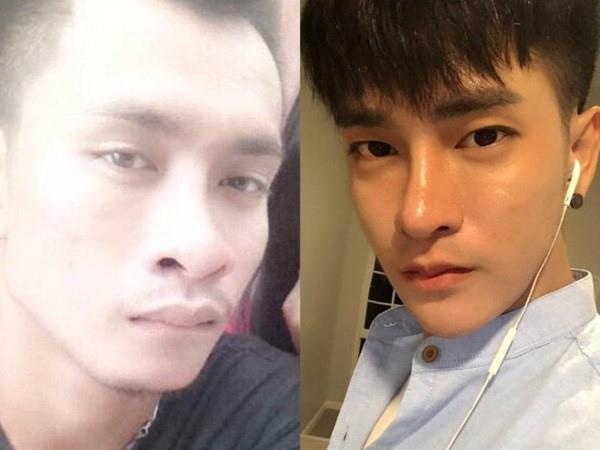 giới trẻ phẫu thuật thẩm mỹ ảnh 2 gioi tre phau thuat tham my anh 2