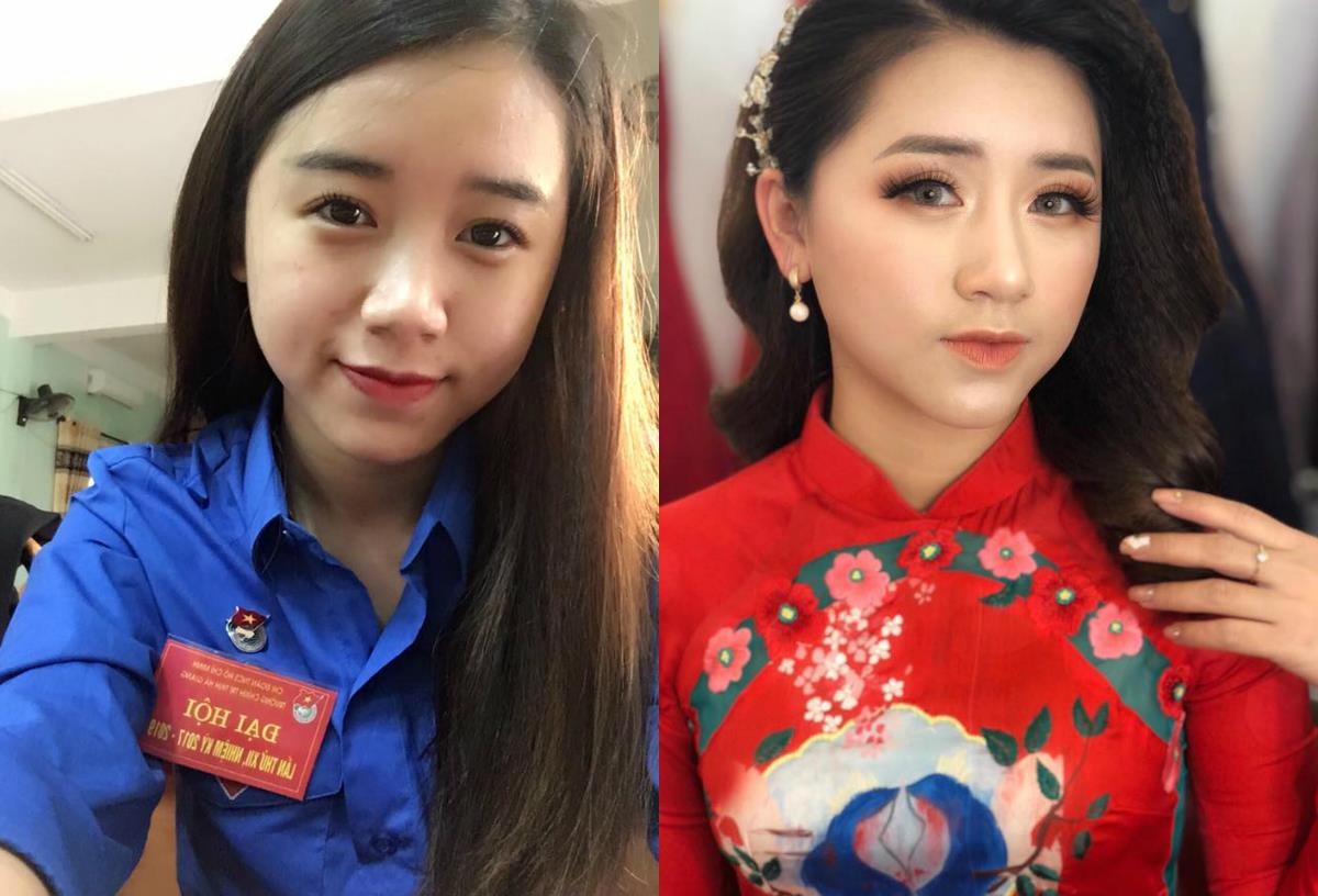 giới trẻ phẫu thuật thẩm mỹ ảnh 1 gioi tre phau thuat tham my anh 1